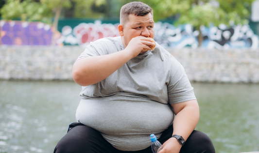 Heavy Financial Costs of Obesity